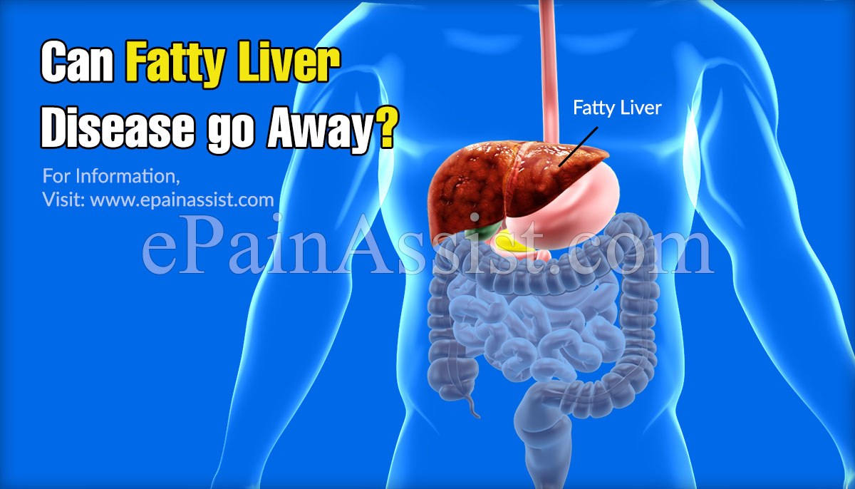 Fatty Liver (Hepatic Steatosis) Signs, Symptoms and How to Prevent It